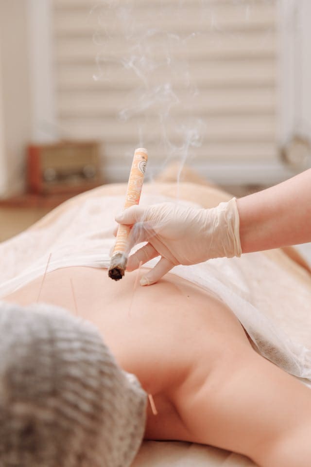 Moxibustion